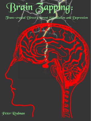 cover image of Brain Zapping